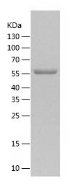    RGS14 / Recombinant Human RGS14