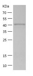    PSTPIP1 / Recombinant Human PSTPIP1