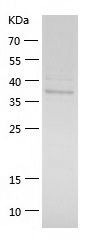    TRC40 / Recombinant Human TRC40