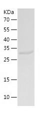    SULT1B1 / Recombinant Human SULT1B1