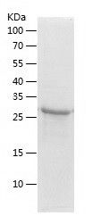    alpha Actinin 4 / Recombinant Human alpha Actinin 4