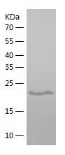    GSTZ1 / Recombinant Human GSTZ1