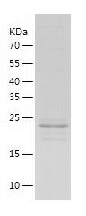    NUDT21 / Recombinant Human NUDT21