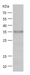    C21orf2 / Recombinant Human C21orf2