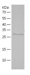    ZFP161 / Recombinant Human ZFP161