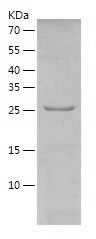 Recombinant Mouse DKK1