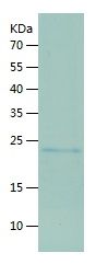 Recombinant Mouse BNIP3