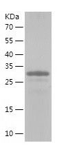    AKR1B10 / Recombinant Human AKR1B10