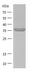    PRPSAP2 / Recombinant Human PRPSAP2