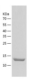    CEP104 / Recombinant Human CEP104