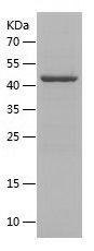    Nephrin / Recombinant Human Nephrin