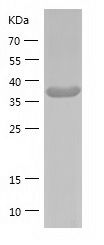    GMDS / Recombinant Human GMDS