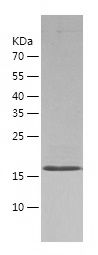    Gremlin 1 / Recombinant Human Gremlin 1