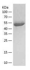    UGDH / Recombinant Human UGDH