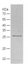    HUS1 / Recombinant Human HUS1