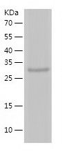 Recombinant Mouse Telomerase reverse transcriptase