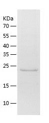 Recombinant Mouse PDK4