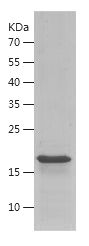    KDM4A / Recombinant Human KDM4A