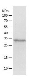    DNAJB6 / Recombinant Human DNAJB6