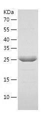    COQ9 / Recombinant Human COQ9