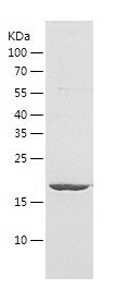    GGCT / Recombinant Human GGCT