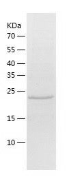    USP12 / Recombinant Human USP12