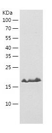    PDCD6 / Recombinant Human PDCD6