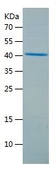    mH2A1 / Recombinant Human mH2A1