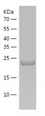    Lysophospholipase 1 / Recombinant Human Lysophospholipase 1