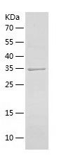    STK16 / Recombinant Human STK16