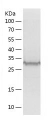    Rad51D / Recombinant Human Rad51D