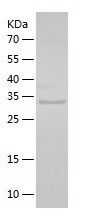    GRAP2 / Recombinant Human GRAP2