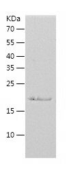    EIF3S1 / Recombinant Human EIF3S1