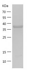    SERPINI2 / Recombinant Human SERPINI2