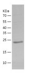    Gankyrin / Recombinant Human Gankyrin