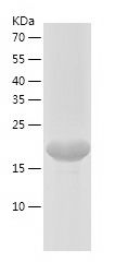    CIB2 / Recombinant Human CIB2