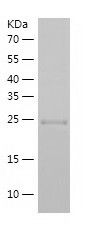    BCAS2 / Recombinant Human BCAS2