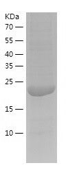    SMNDC1 / Recombinant Human SMNDC1