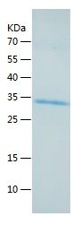    Stanniocalcin 2 / Recombinant Human Stanniocalcin 2