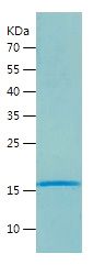    gamma Synuclein / Recombinant Human gamma Synuclein