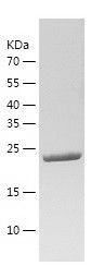    WISP2 / Recombinant Human WISP2