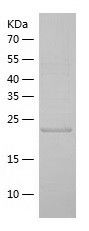    ZFAND5 / Recombinant Human ZFAND5