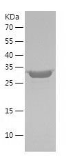    GlcAT-I / Recombinant Human GlcAT-I