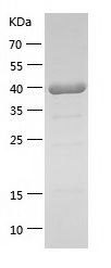    DRAK2 / Recombinant Human DRAK2