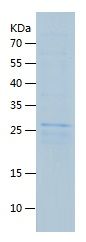    DKK1 / Recombinant Human DKK1