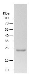    ZWINT / Recombinant Human ZWINT