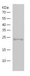    MBD4 / Recombinant Human MBD4