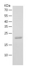    TNFAIP8 / Recombinant Human TNFAIP8