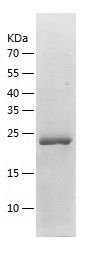    NADK / Recombinant Human NADK