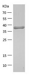    TDP2 / Recombinant Human TDP2